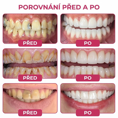 🇨🇿 Oficiální e-shop🦷❤️𝐑𝐨𝐥𝐢𝐦𝐞𝐲® 𝐃𝐞𝐧𝐏𝐞𝐫𝐦 – 𝐏𝐫̌𝐢́𝐫𝐨𝐝𝐧𝐢́ 𝐠𝐞𝐥 𝐧𝐚 𝐯𝐲́𝐩𝐥𝐧̌ 𝐳𝐮𝐛𝐧𝐢́ 𝐬𝐤𝐥𝐨𝐯𝐢𝐧𝐲 𝐩𝐫𝐨 𝐨𝐩𝐫𝐚𝐯𝐮 𝐳𝐮𝐛𝐧𝐢́𝐡𝐨 𝐤𝐚𝐳𝐮