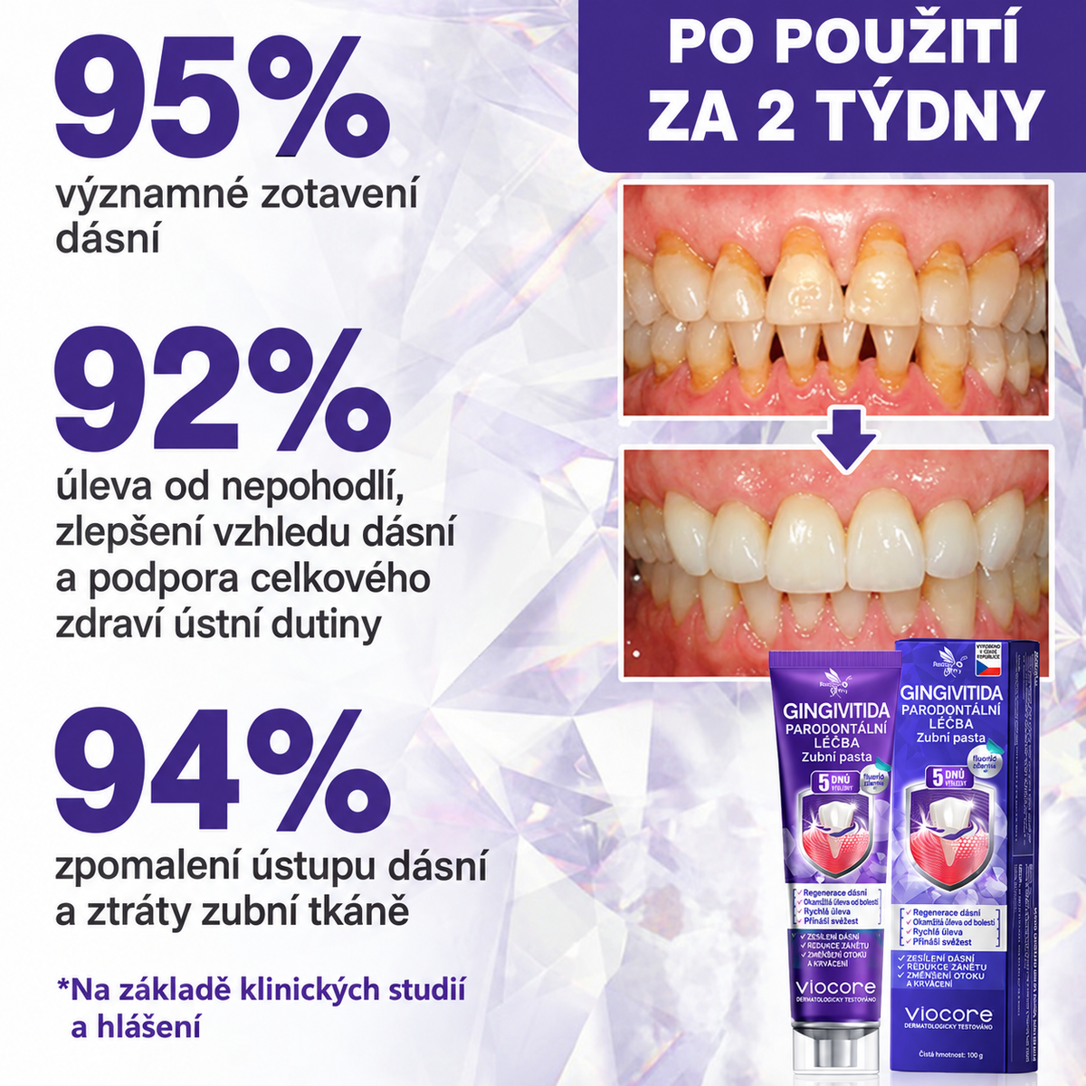 🇨🇿 Oficiální e-shop🌺✔Rolimey® VioCore Zubní pasta na léčbu zánětu dásní a parodontitidy s včelím jedem