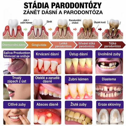 🇨🇿 Oficiální e-shop🌺✔Rolimey® VioCore Zubní pasta na léčbu zánětu dásní a parodontitidy s včelím jedem