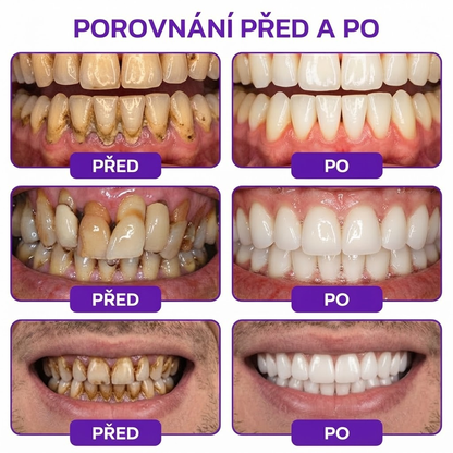 🇨🇿 Oficiální e-shop🌺✔Rolimey® VioCore Zubní pasta na léčbu zánětu dásní a parodontitidy s včelím jedem